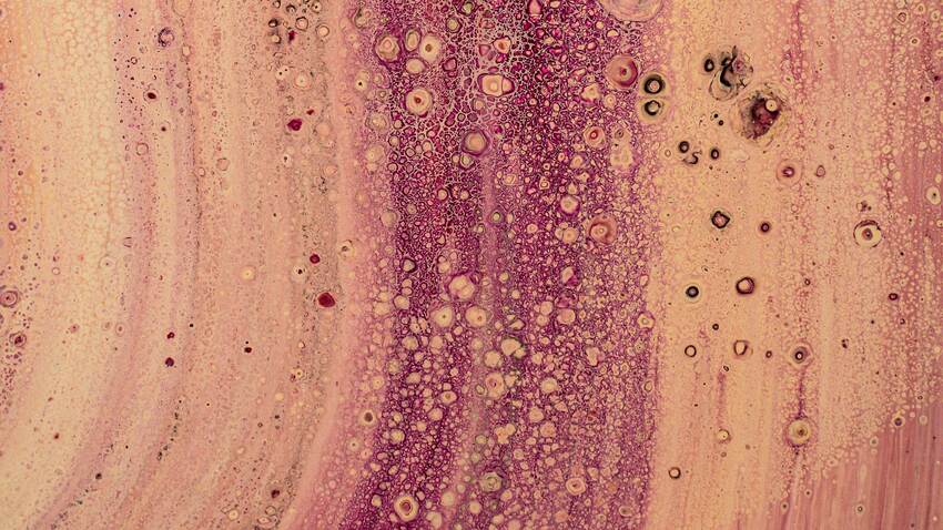 Bone marrow closeup